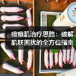 痘痘肌治疗思路:破解肌肤困扰的全方位指南(图4) 痘痘肌治疗思路:破解肌肤困扰的全方位指南(图4)