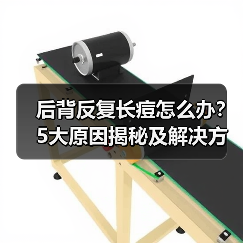 后背反复长痘怎么办?5大原因揭秘及解决方法(图3) 后背反复长痘怎么办?5大原因揭秘及解决方法(图3)