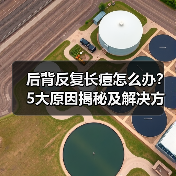 后背反复长痘怎么办?5大原因揭秘及解决方法(图2) 后背反复长痘怎么办?5大原因揭秘及解决方法(图2)