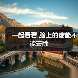 一起看看 脸上的痣能不能去除(图4) 一起看看 脸上的痣能不能去除(图4)