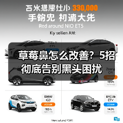 草莓鼻怎么改善?5招彻底告别黑头困扰(图3) 草莓鼻怎么改善?5招彻底告别黑头困扰(图3)